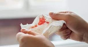 Pojawienie się flegmy z krwią: Sygnały alarmowe wymagające lekarza