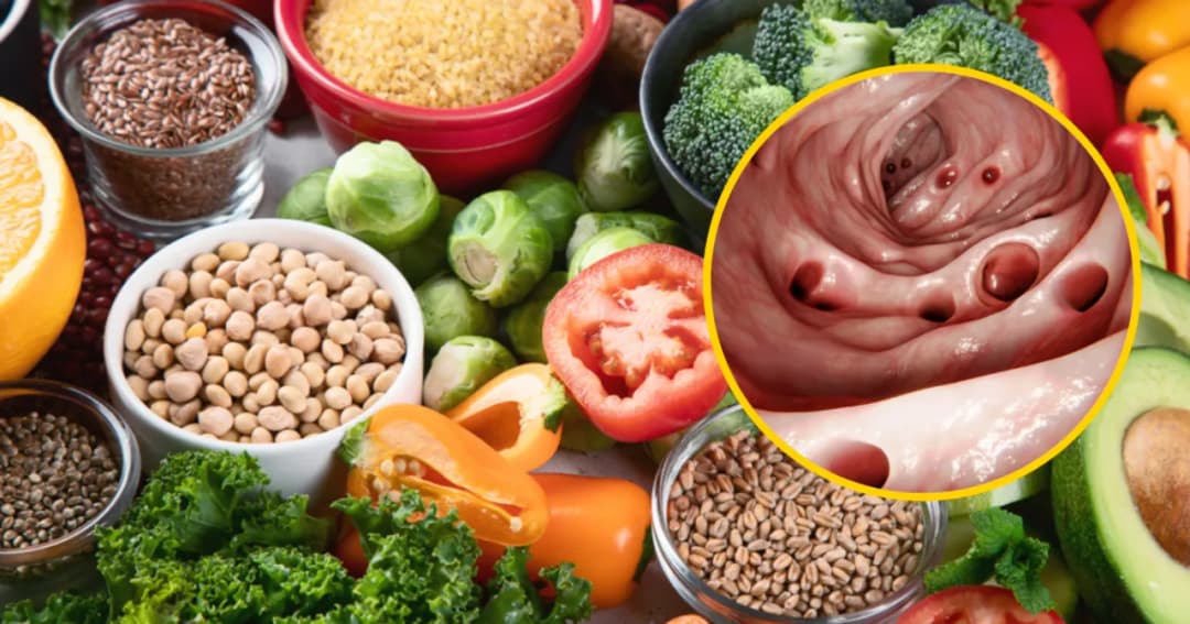 Dieta przy zapaleniu uchyłków jelita grubego - co jeść, przepisy