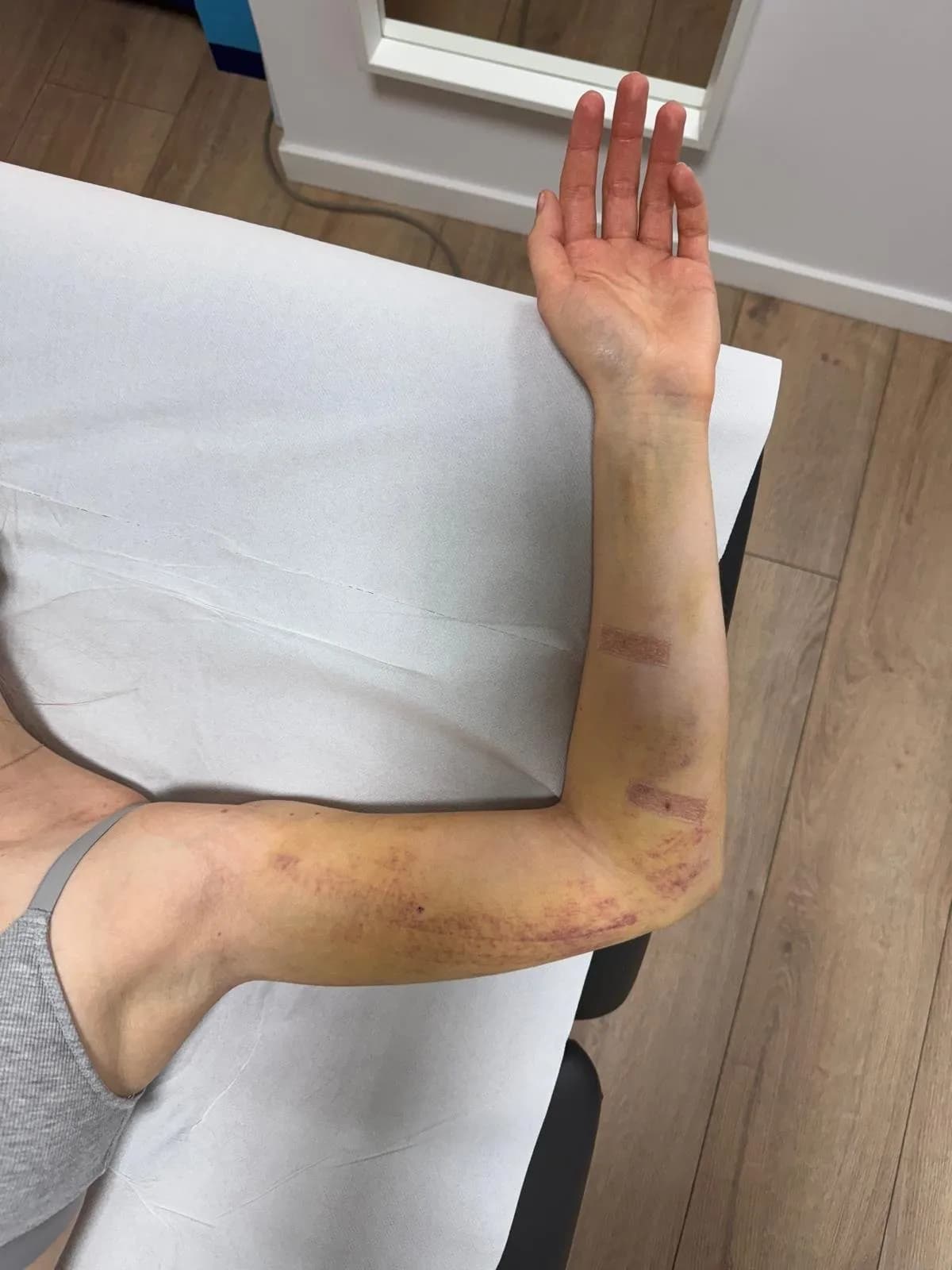 fizjoterapia estetyczna warszawa