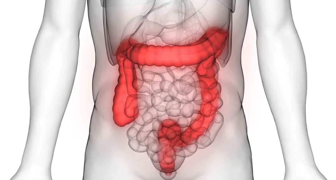 Jelito grubego choroby objawy: Jakie są objawy chorób jelita grubego?