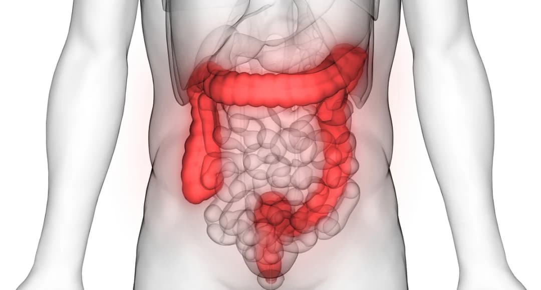 Jelito grubego choroby objawy: Jakie są objawy chorób jelita grubego?