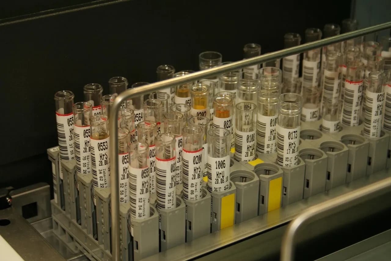 Nie każda probówka jest taka sama. Jak wybrać odpowiednią do profesjonalnego laboratorium?