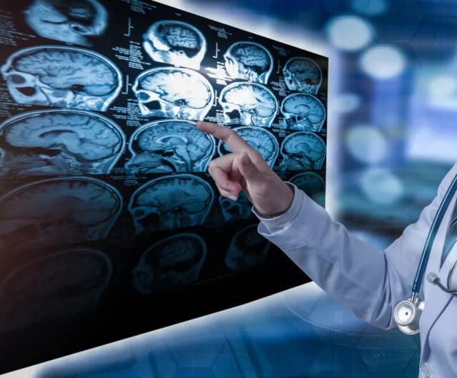 Co to SM: SM - tajemnicza choroba demielinizacyjna